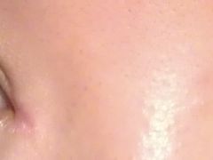 双眼皮-上海华安整形外科门诊部