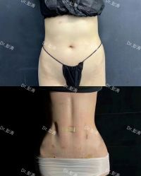 -杭州米兰柏羽医疗美容医院