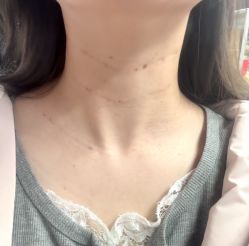 -杭州米兰柏羽医疗美容医院