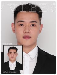 -大麦微针植发全国连锁