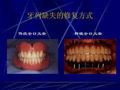 -团圆口腔·种植中心(锦江院区)