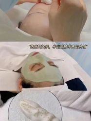 -苗方清颜痘肌研究所