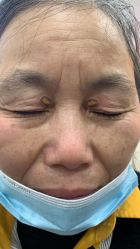 -美人痣全国连锁