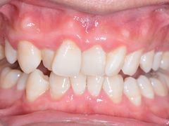 -新达口腔(华东理工大学店)