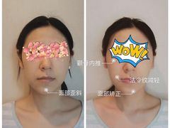 -FACE·日本小颜美容整骨(福田店)
