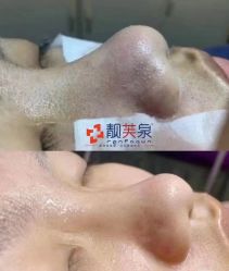 -靓芙泉祛痘.科技美肤连锁