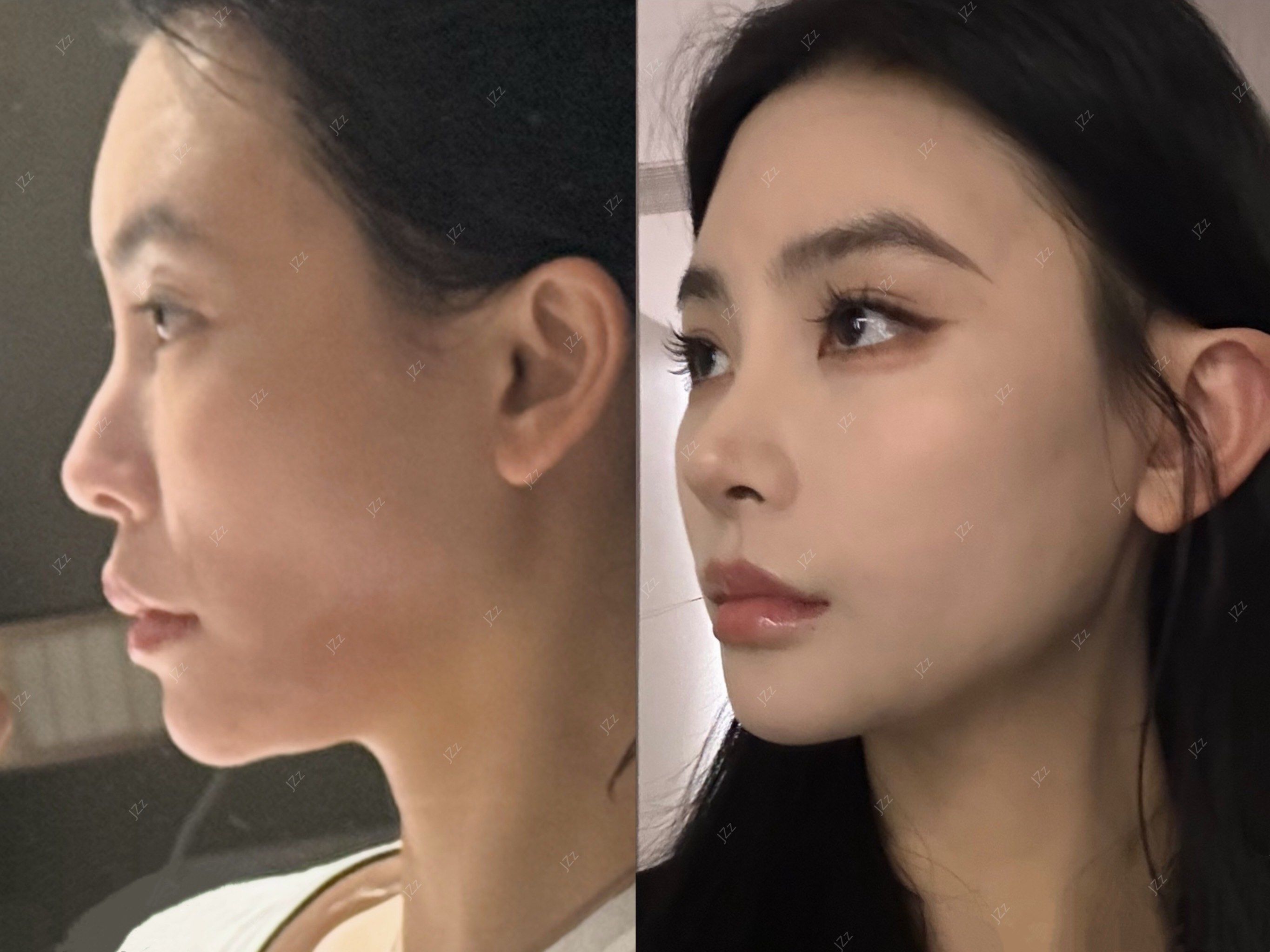 从嘴凸到高级侧颜我做对了什么❓