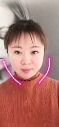 -纯粹医美
