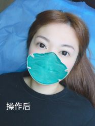 -西施无菌半永久纹绣眉眼影唇轻增发纹发际线