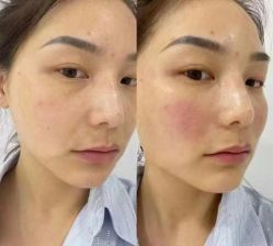 -南京美莱医疗美容·旗舰店