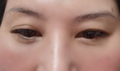 体验后-华臣医疗美容