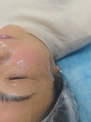 -长沙雅美医疗美容医院