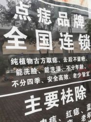 点击看大图 -痣缘宫