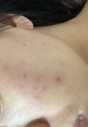 -慕颜医疗美容·皮肤微整 抗衰