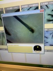 -LESSMORE科技头皮理容中心