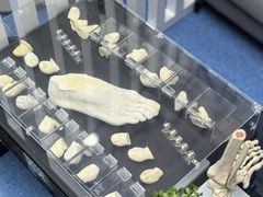 -Andrew指甲专科灰指甲·甲沟炎矫正·3D步态矫形鞋垫定制(上海法华镇路旗舰店)