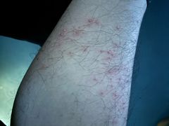 -华夏良子·足道SPA艾灸(龙潭路店)