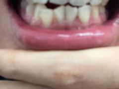 -微笑牙科口腔(三亚迎宾院区)