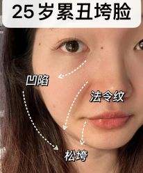 -LUNA皮相美·骨相美高级美感