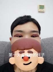 体验后-苏亚医美·高端注射明星整形机构