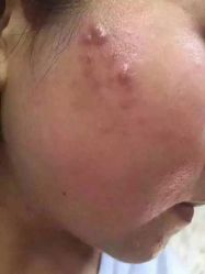 英树玻尿酸羊胎素化妆品-英树玻尿酸羊胎素专营化妆品