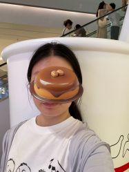 体验后-斐研美医疗美容·眼周抗衰中心