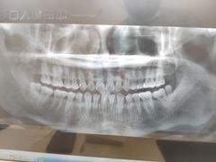 -土豆口腔(凤凰北总店)