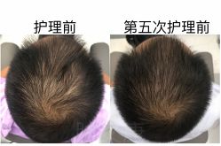-天其美科学美肤·生发健康管理