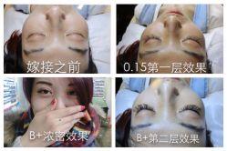 点击看大图 睫作B+套餐-光SPA科技美肤