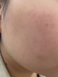 -美瑞莎创美医疗美容