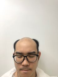 -发饰美男士增发补发假发定制店