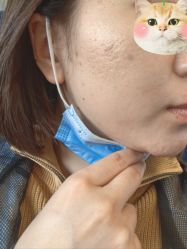 体验后-张小熊连锁轻医美