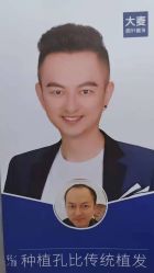 -大麦微针植发全国连锁