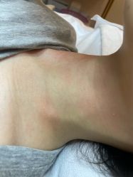 -清疣美疣·痣·斑净肤中心
