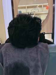-大麦微针植发丨全国连锁