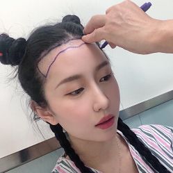 -碧莲盛·不剃发植发