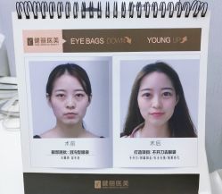 -天津健丽·去眼袋医疗美容机构