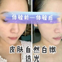 -广州健丽·去眼袋医疗美容机构