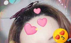 -大麦微针植发全国连锁