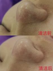 -蕾特恩专业祛痘·皮肤管理
