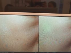 -苑苑vbeauty科技美容SPA