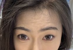 -天津健丽·去眼袋医疗美容机构