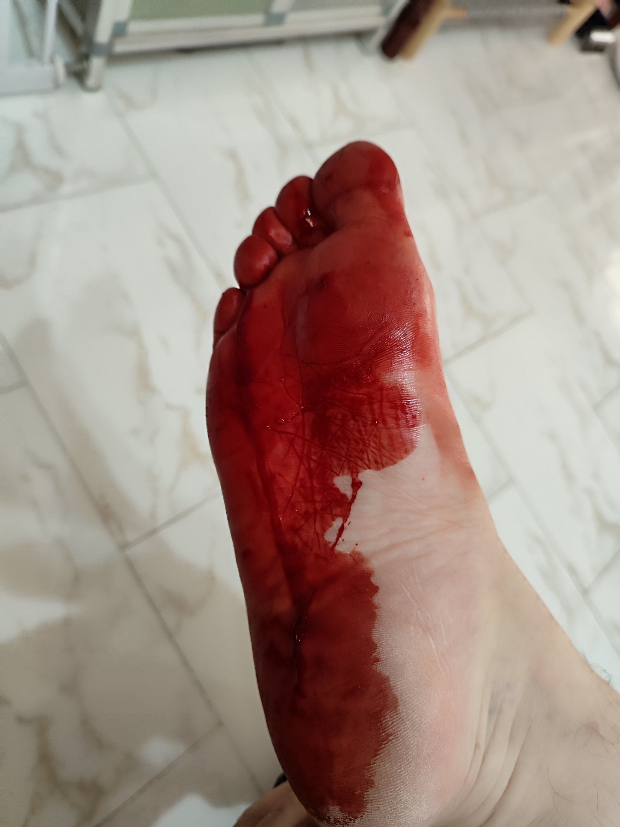 走个路脚被扎穿了!哎!