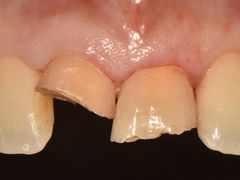 -精德口腔·种植修复·儿牙中心(财富中心店)