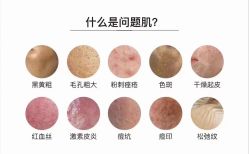 -痘庄科学祛痘国际连锁