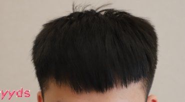 -大麦微针植发丨全国连锁