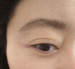 -德绣·机器野生眉发际线·美瞳线半永久