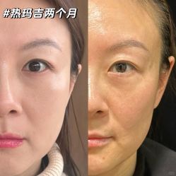 -上海伊莱美医疗美容医院