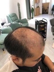 -发饰美男士增发补发假发定制店