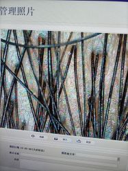 点击看大图 -大麦微针植发丨全国连锁